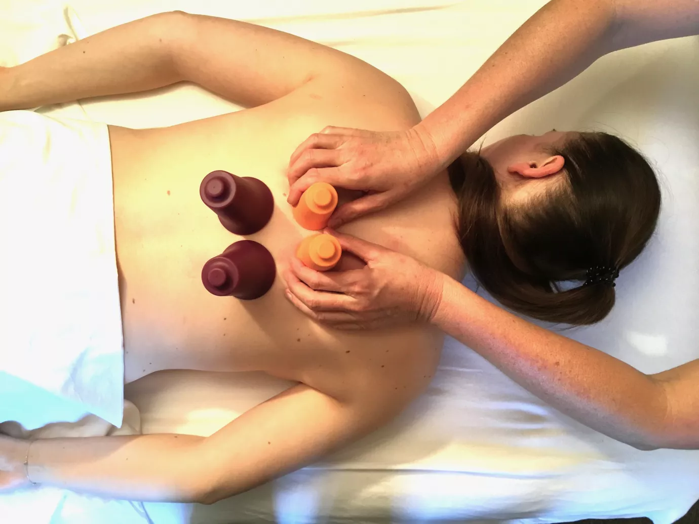 Cupping (Schröpfkopfmassage) Cupping (Schröpfkopfmassage)